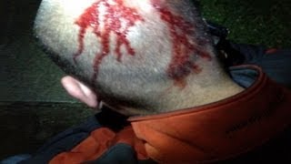 Zimmerman Injuries Seen in Exclusive Photo Pictures from Night of Trayvon Martins Death [upl. by Stander]