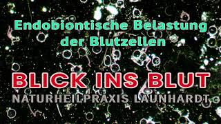 Blick ins Blut  Endobiontisch belastete Blutzellen [upl. by Sherar]