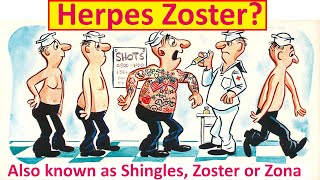 What is Herpes Zoster [upl. by Ozzie]