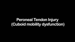 Peroneal Tendon Injury Cuboid mobility dysfunction [upl. by Lorraine273]