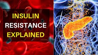 Insulin Resistance Explained  Why And How It Happens  Key Signs And Symptoms To Look Out For [upl. by Ireva]