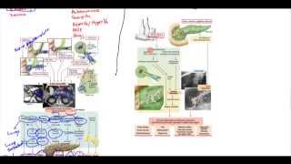 Acute Pancreatitis Chronic Pancreatitis Psuedocyst Adenocarcinoma [upl. by Burta]