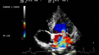 endocardite mitralica con controllo mitral endocarditis dog [upl. by Auerbach555]