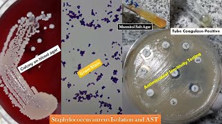 Staphylococcus aureus golden yellow colonies Gram stain Coagulase test Growth on MSA and AST [upl. by Aviva]