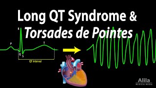 Long QT Syndrome and Torsades de Pointes Animation [upl. by Ober]