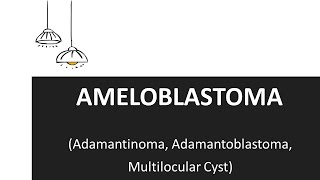 Ameloblastoma  Clinical Features and Treatment of Ameloblastoma [upl. by Colwin356]