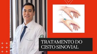 Tratamento do Cisto Sinovial [upl. by Jaclyn]