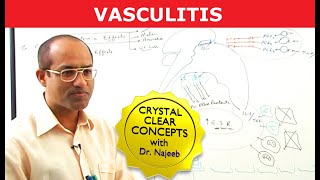 Vasculitis  Causes Symptoms amp Treatment [upl. by Retluoc]