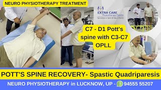 Potts Spine Physiotherapy Rehab  Best Exercises for Potts Spine  TB of Spine  Extra Care Lko [upl. by Elvin]