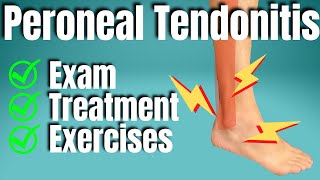 Peroneal Tendonitis Treatment  San Diego Sports Chiropractic [upl. by Saundra919]