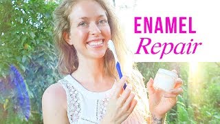 How I Naturally Restored My Enamel and Remineralized My Teeth [upl. by Karylin]