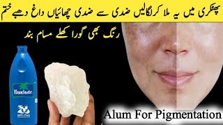 AlumFitkari for remove Pigmentation and darkspotsPhitkari Alum Benefits Phitkari Ke Fayde [upl. by Anomer]