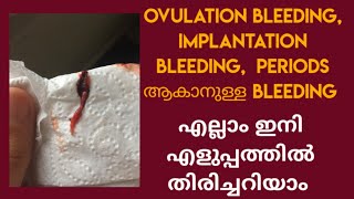 Ovulation bleedingImplantation bleedingperiods ആകാനുള്ള bleeding എല്ലാം ഇനി എളുപ്പo തിരിച്ചറിയാം [upl. by Riamo]