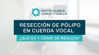 Resección de Pólipo en Cuerda Vocal  ¿Qué es y cómo se realiza [upl. by Irab]