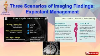 Three Scenarios of Imaging Findings Expectant Management [upl. by Engedi]