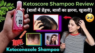 Ketoscore shampoo uses in hindi  Ketoconazole shampoo  Ketoscore shampoo review  Ketoscore [upl. by Hadley]