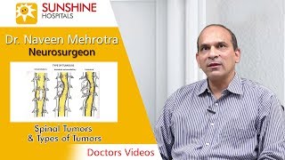 Watch Dr Naveen Mehrotra Consultant Neurosurgeon talk about Spinal Tumor amp Types of Spinal Tumors [upl. by O'Reilly187]