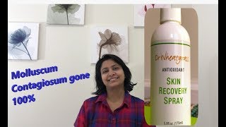 HOW TO TREAT MOLLUSCUM CONTAGIOSUM TRY Dr Wheatgrass skin recovery spray works 100 [upl. by Berkie413]