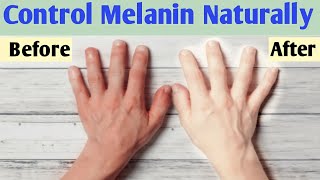 How to reduce melanin in skin naturally  Melanin kam karne ke upay [upl. by Carrelli737]