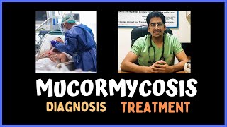 MUCORMYCOSIS Clinical features Diagnosis amp Treatment [upl. by Vadim]