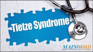 Tietze Syndrome ¦ Treatment and Symptoms [upl. by Calista]