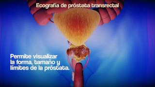 Ecografía Prostata transrectal [upl. by Jarrow]