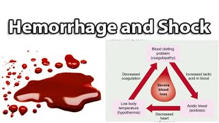 Hemorrhage amp Shock 3  Classification of Shock  UQs [upl. by Nylynnej]