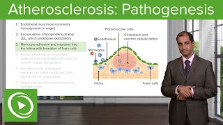 Atherosclerosis Pathogenesis amp SupplyDemand Mismatch – Cardiovascular Pathology  Lecturio [upl. by Claybourne404]