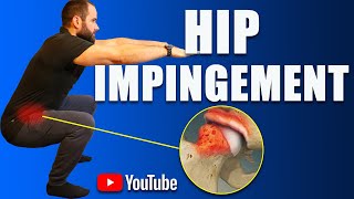 Hip Impingement Pain FAI Best Exercises Rehab amp Strengthening How to Avoid Surgery [upl. by Zollie]