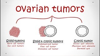 Ovarian Tumors All types Pathology [upl. by Norton985]