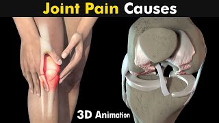 What Causes Joint Pain  Osteoarthritis And Rheumatoid arthritis 3D Animation [upl. by Addia]