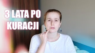 Czy powtórzyłabym kurację retinoidami3 lata później  axotret trądzik retinoidy [upl. by Bradshaw]