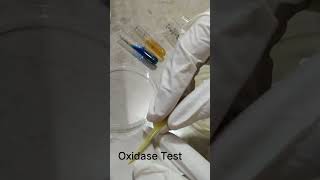 Oxidase test [upl. by Anifares888]