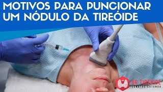 🔴Motivos para puncionar um nódulo da tireóide  Dr Tireóide Responde 49 [upl. by Yldarb]