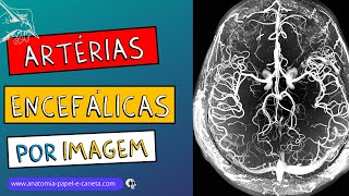 ANGIOGRAFIAS  ARTERIOGRAFIAS  ARTÉRIAS do encéfalo na imagem [upl. by Asum]