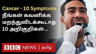 Cancer 10 Symptoms இதை சீக்கிரம் கவனிச்சிட்டா Treatment மூலம் குணப்படுத்திவிடலாம் [upl. by Nelubez]