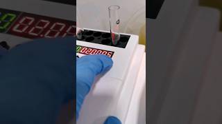 Triglycerides test of a lipemic serum sample medtech laboratory medtechstudent rmt medtechknows [upl. by Letnoj]