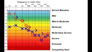 Setup Audiograms [upl. by Pruter259]