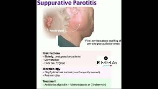 💠 Supurrative parotitis 💠 [upl. by Nae]