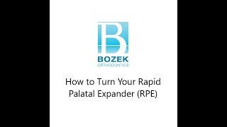 How to Turn Your Rapid Palatal Expander RPE [upl. by Nodle]