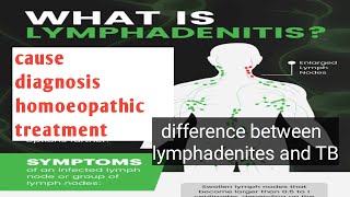 lymphadenites lymphadenitestypes cause diagnosis homoeopathictreatmenthomoeopathy [upl. by Nalla]