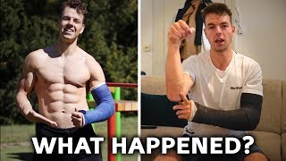 How to Avoid my Injury Golvers Elbow  4 Tips with Calisthenics Training [upl. by Frydman]