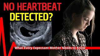 No Heartbeat Detected in Early Pregnancy Ultrasound What Every Expectant Mother Needs to Know [upl. by Inaniel367]