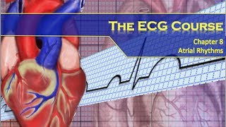 The ECG Course  Atrial Rhythms [upl. by Fanechka]