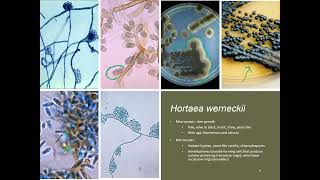 Dematiaceous Molds [upl. by Hafeenah]