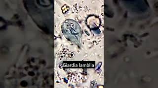 Giardia lambliaGiardiasis parasiteparasite under microscope microscopy parasitology [upl. by Aylat]