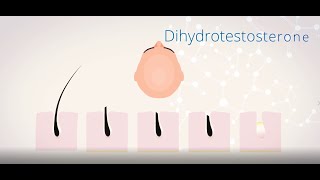 How DHT Blockers for Hair Loss Work [upl. by Nyrac]