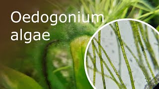 Oedogonium Algae Under a Microscope 100x1000x [upl. by Aenad]