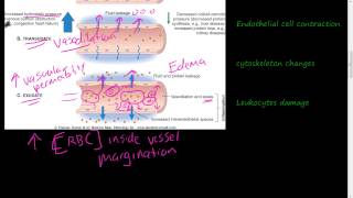 19  Acute Inflammation 1 of 3  Vascular permeability Vasodilation [upl. by Natika]