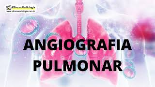 ANGIOGRAFIA PULMONAR [upl. by Hillari]